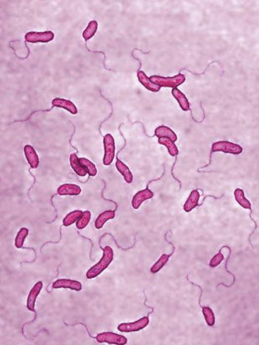 Bacteria Intoxicaciones por mariscos: el riesgo de Vibrio parahaemolyticus en productos del mar
